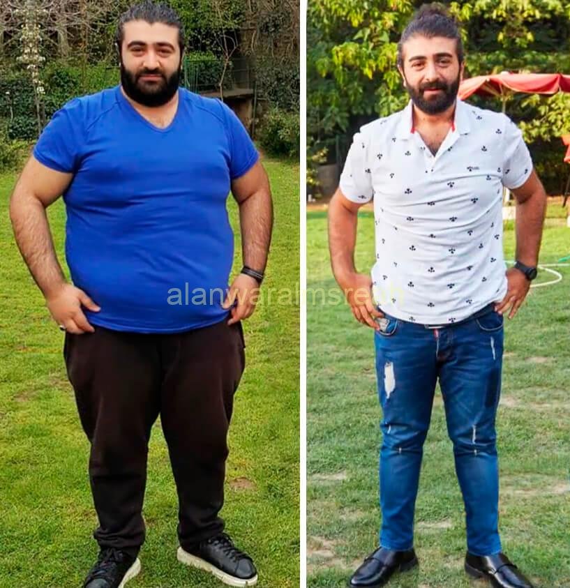 كيف فقدت 40% من وزني: قصـة رجل فقد 56 كجم