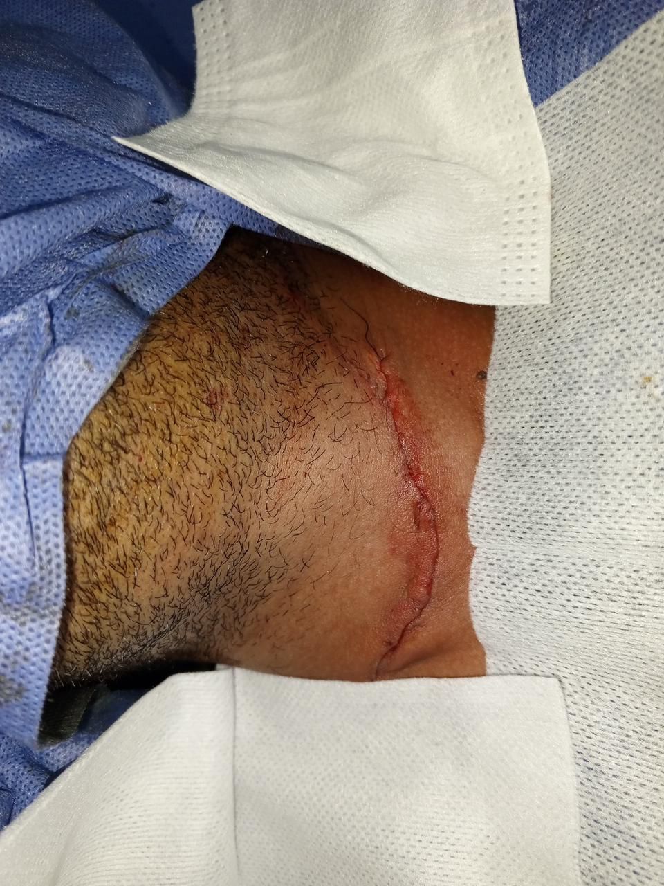 مستشفي جامعة سوهاج تنجح في إنقاذ حياة شاب تعرض لقطع في الشرايين الأمامية للرقبة