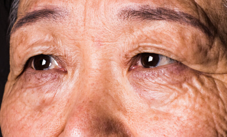 الدراسة تظهر