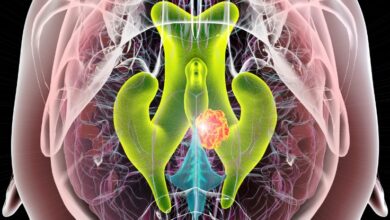 السائل النخاعي