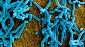 مرض غامض يطرق أبواب إفريقيا.. والعالم يترقّب