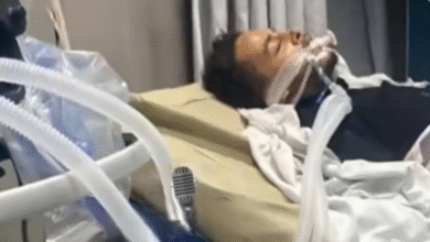 آخر تطورات الحالة الصحية للمطرب إسماعيل الليثي