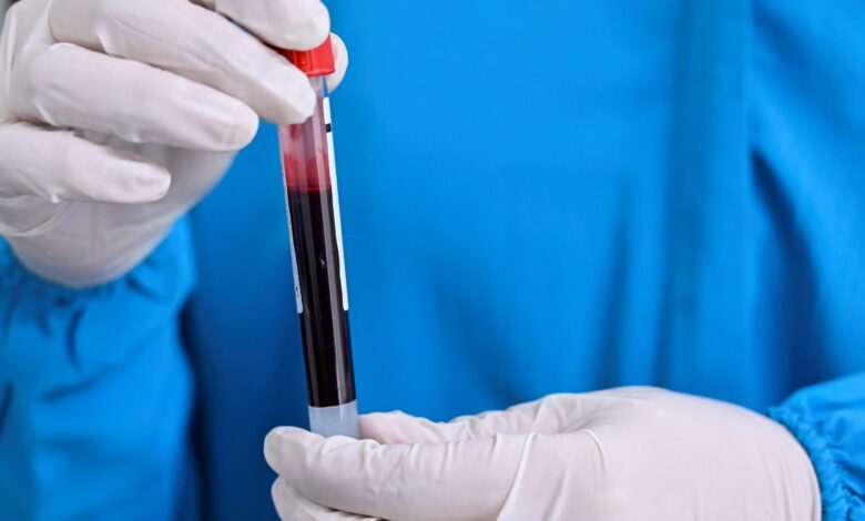 فحص دم بسيط قد يكشف احتمال وفاتك خلال العقد القادم